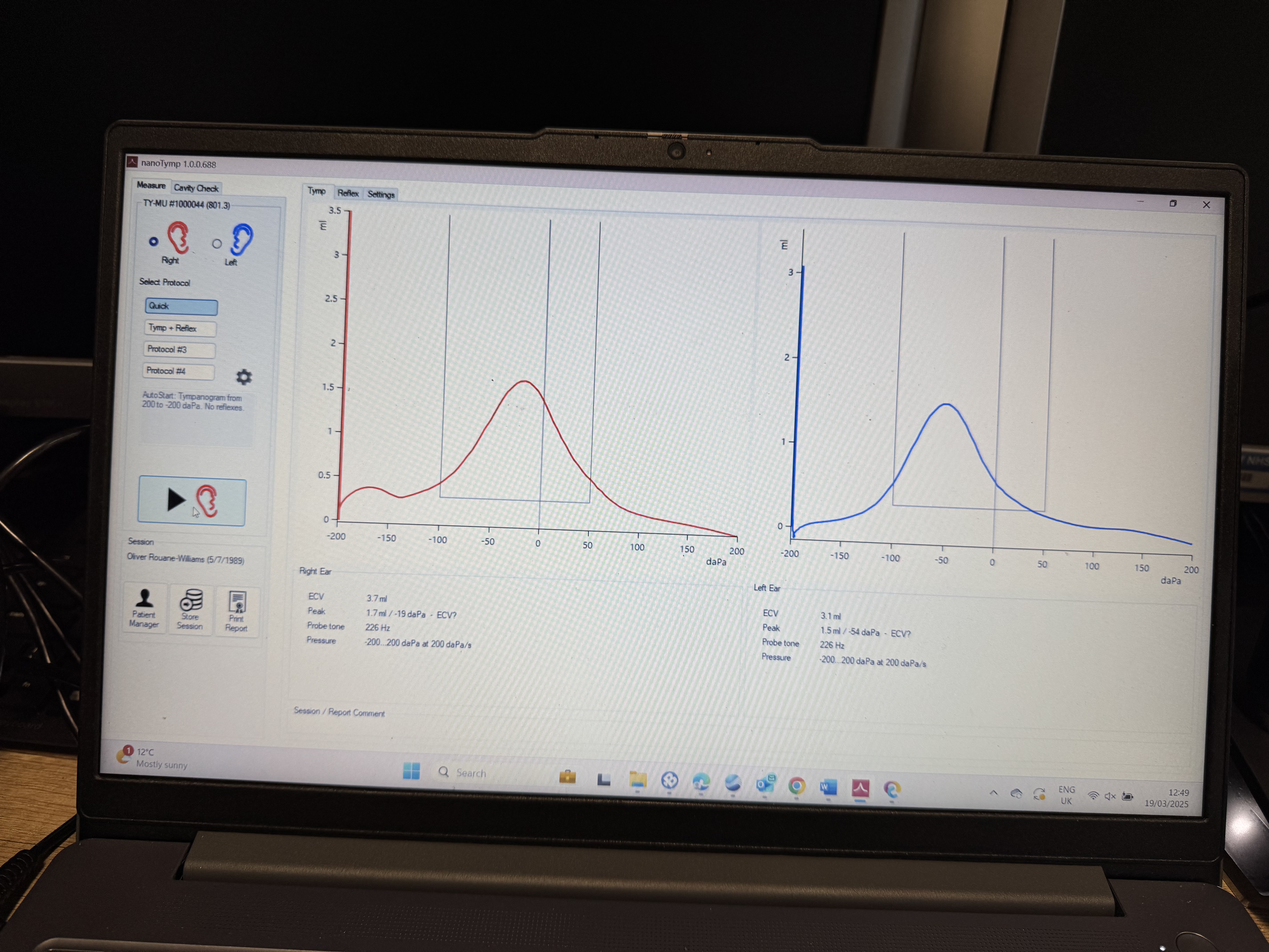My air and bone conduction testing results