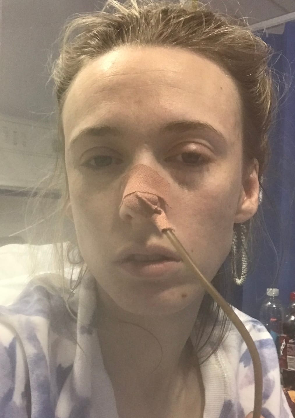 Close-up of Monica Thomas in a hospital bed with a nasogastric tube taped to her nose, looking visibly unwell and exhausted.